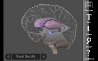 3D Brain